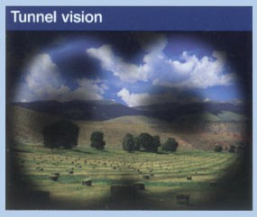 Sample of Tunnel Vision